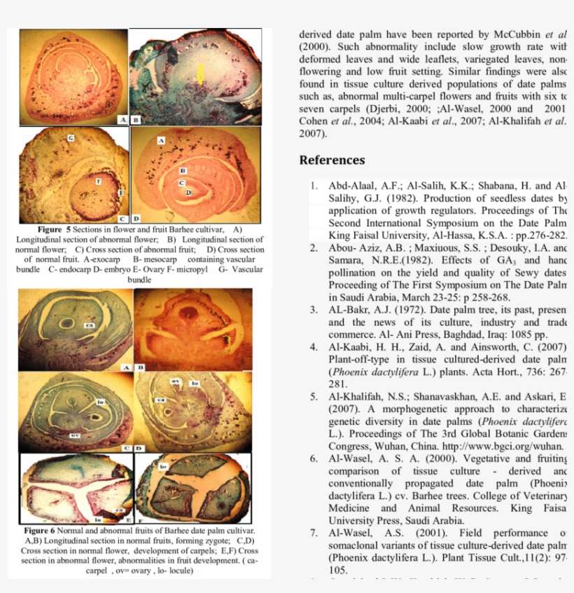 Pollen Grains Of Anthers In Normal And Abnormal Flowers - Pollen, transparent png download