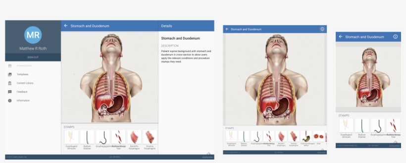 Works On Iphone, Ipad, Web And Android - Android, transparent png download