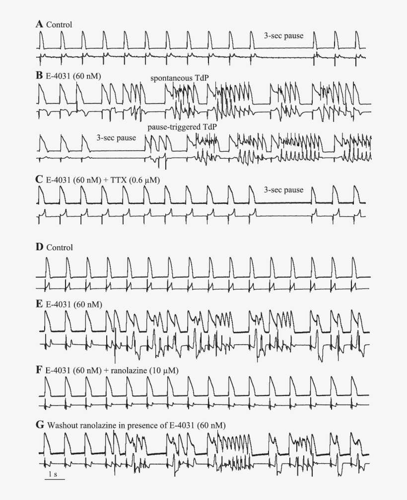 Representative Recordings Of The Anti Arrhythmic Effects - Handwriting, transparent png download