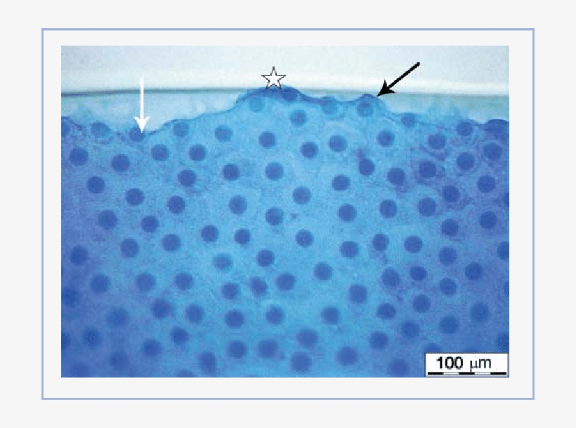 Anterior Lens Capsule Following Manual Capsulorhexis - Swimming Pool, transparent png download