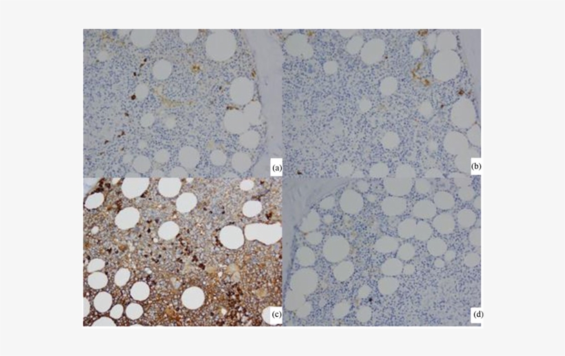 200×, Few Plasma Cells Positive For Kappa Light Chain - Tile, transparent png download