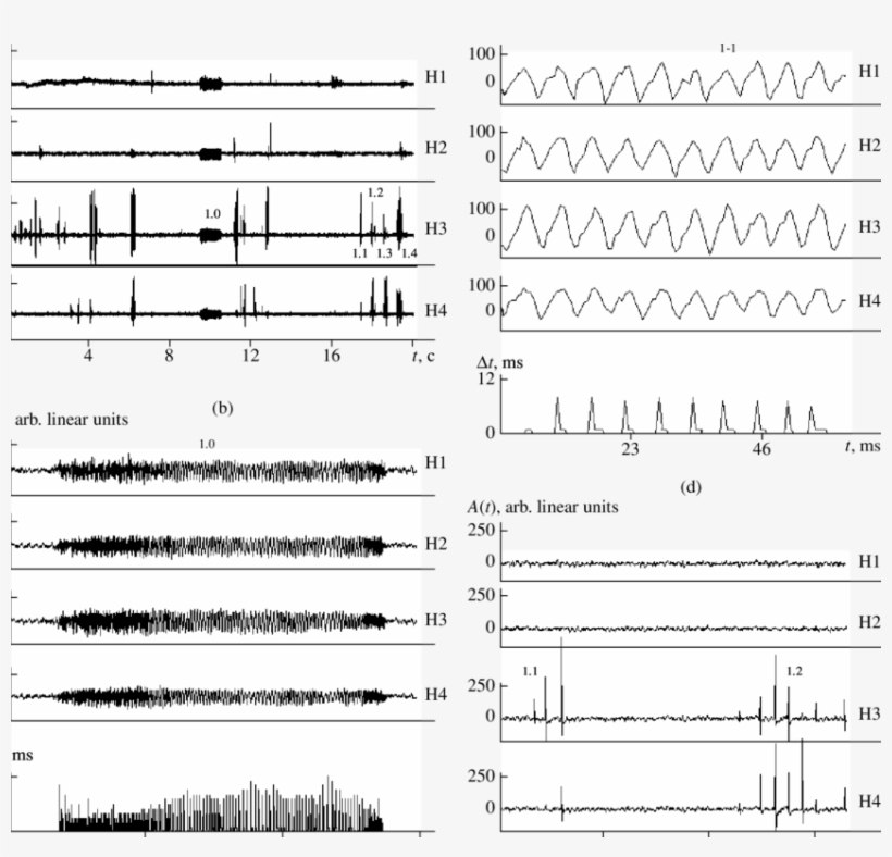 Probing Signals Used By The Beluga Whale In Searching - Sheet Music, transparent png download