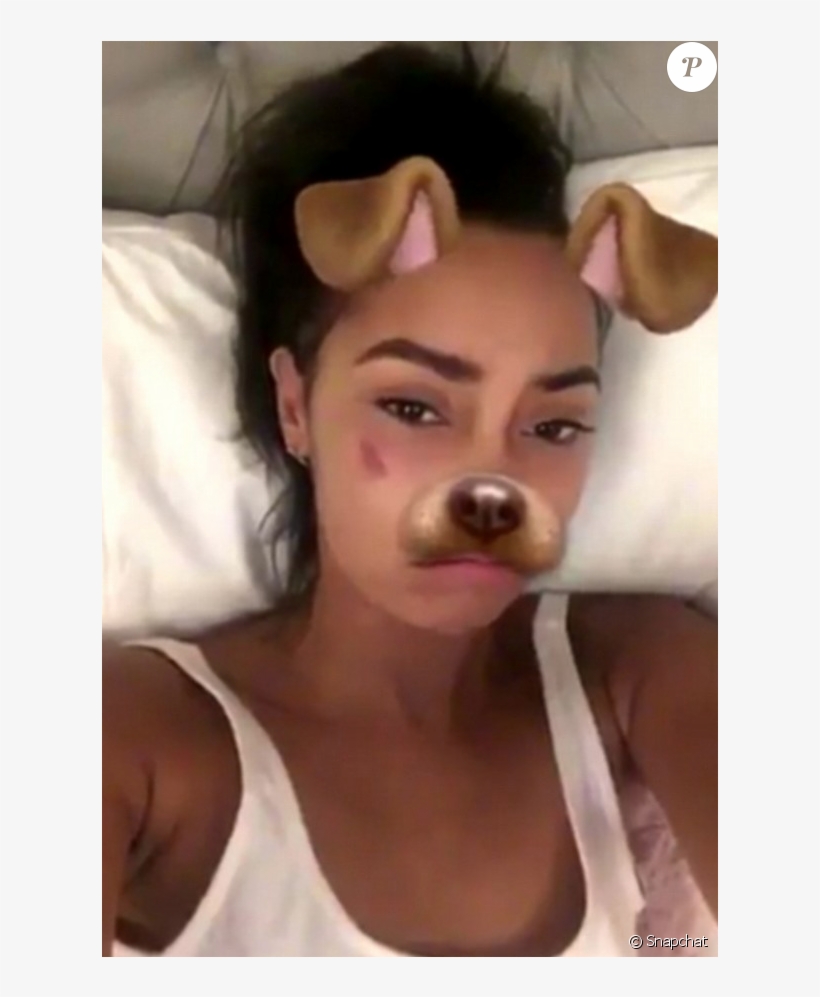 Leigh-anne Pinnock, La Chanteuse Des Little Mix A Publié - Tiny Bruise On Face, transparent png download