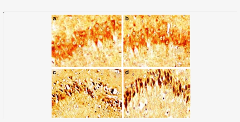 Effect Of Egcg On The Hippocampus After Fl Exposure - Common Fig, transparent png download