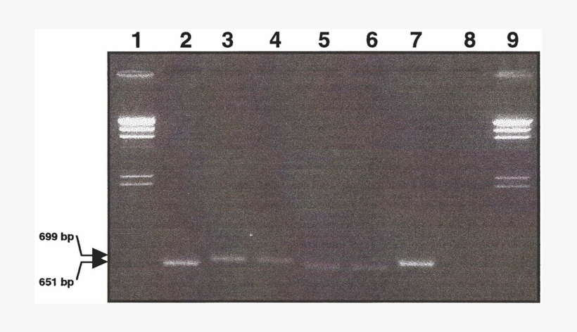 Amplification By Pcr Of The Phaseolin Coding Regions, transparent png download