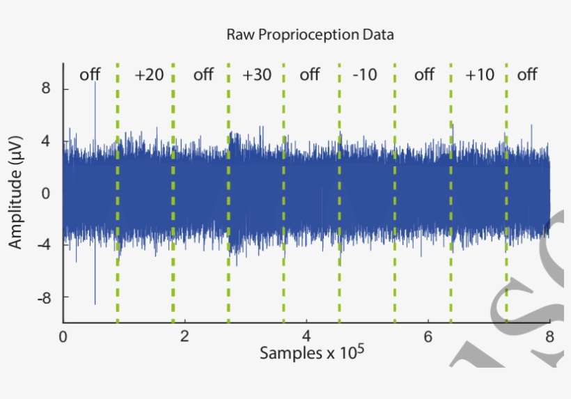 Filtered Nerve Signal Recorded From One Electrode On, transparent png download