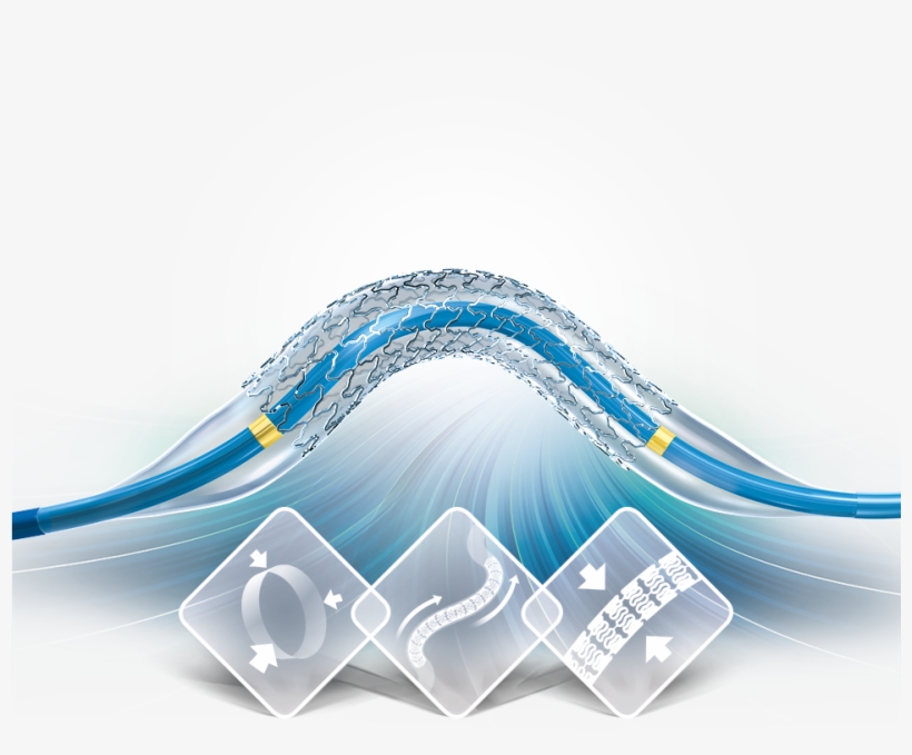 Cobalt-chromium Endovascular Stent System, transparent png download