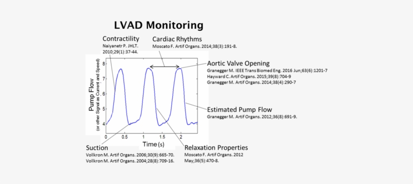 Hemodynamic Parameters Analyzed Using Ready Available - Ventricular Assist Device, transparent png download