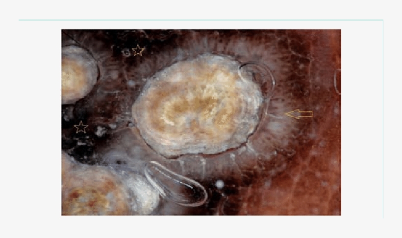 Close Up View Showing Demonstrates Yellowish-white - Yellow, transparent png download