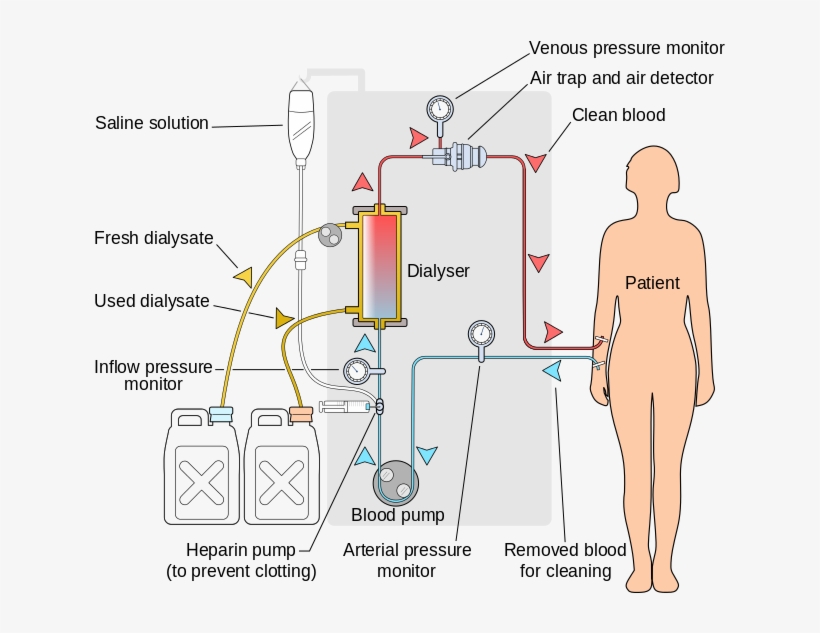 Hemodialysis Acts As An Artificial Kidney To Filter - Artificial Kidney Dialysis, transparent png download