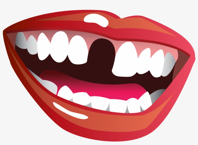 Smile With Missing Tooth, transparent png download