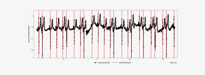 Actual Heartbeat Detected Beat To Beat - Pulse, transparent png download