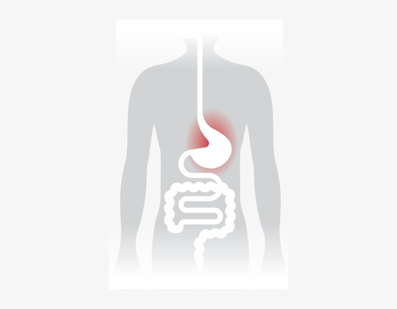 Burning - Urea Breath Test, transparent png download
