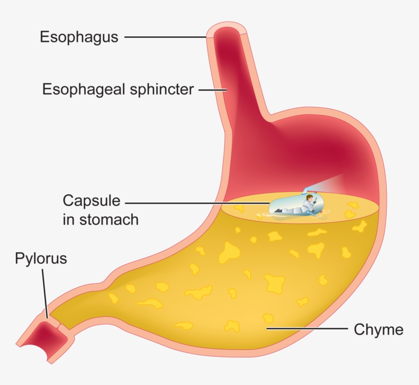 Chyme Stomach Chyme PNG Image Transparent PNG Free Download on SeekPNG