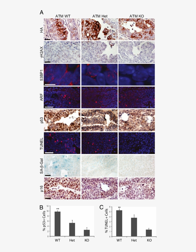 Atm Ablation Results In Reduced Ddr Signaling, Apoptosis,, transparent png download