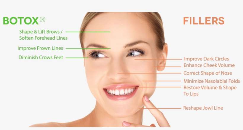 Botox® Fillers Oakville - Botox And Fillers, transparent png download