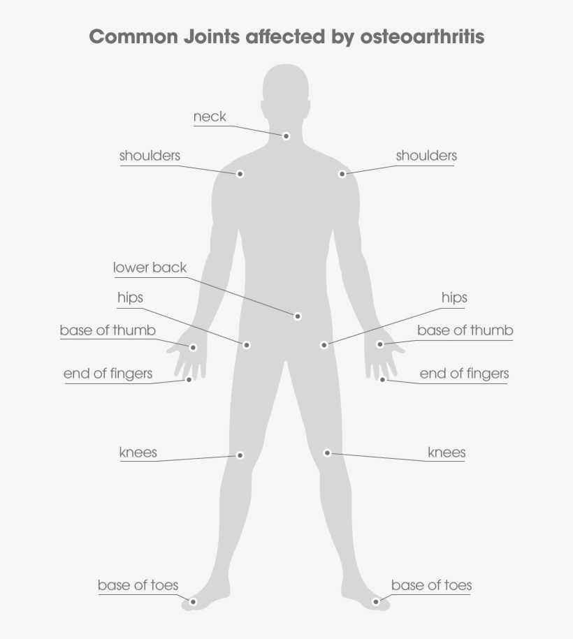 Severe Osteoarthritis Of The Large Joints Like The - Man, transparent png download