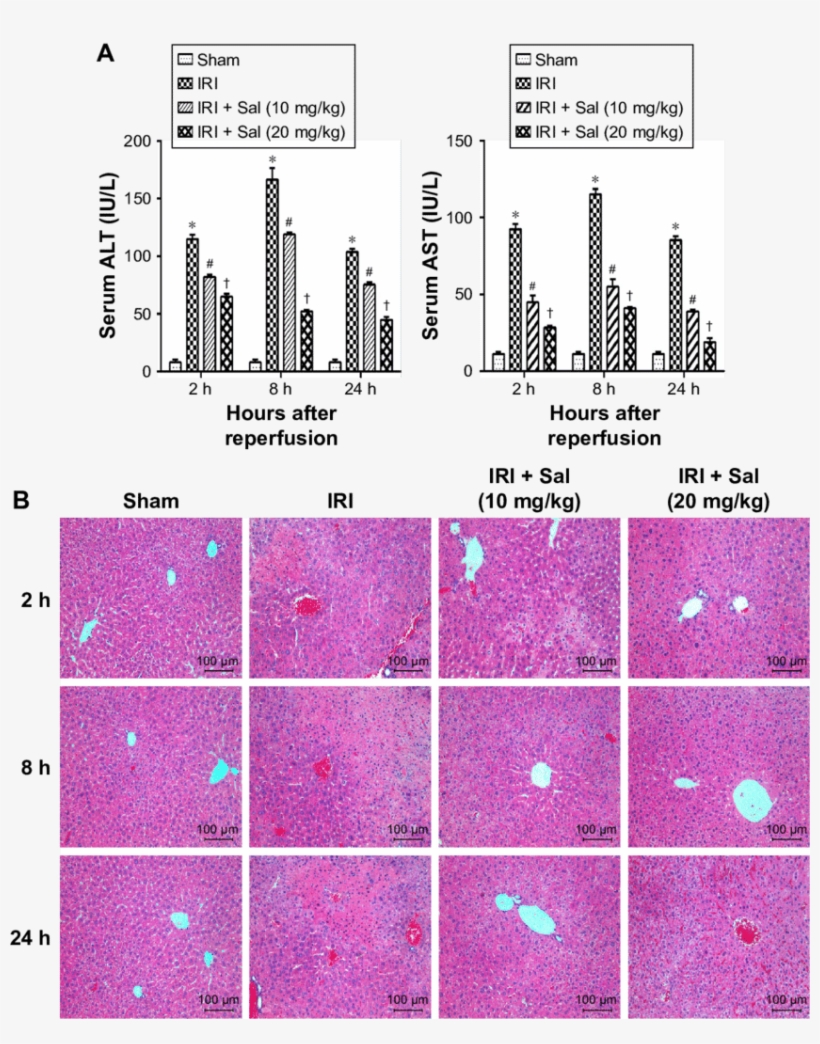 Effects Of Sal On The Liver Function And Histopathology - Diagram, transparent png download