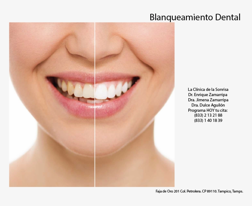 Save To Collection - Much Is Teeth Whitening, transparent png download