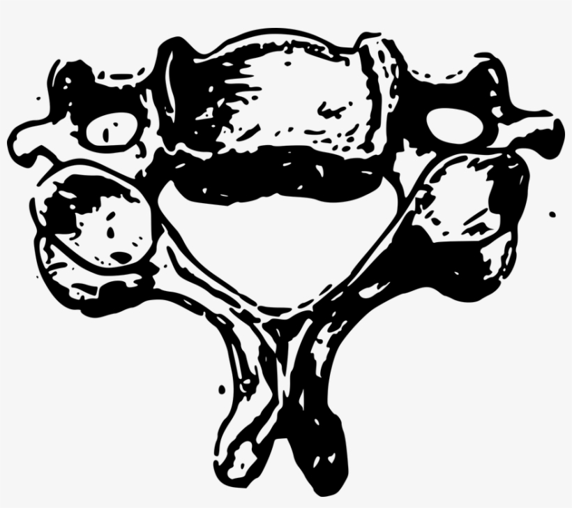 Anatomy, Bone, Cervical, Human, Neck, Osteology, Spine - Dibujo De Vertebra Cervical, transparent png download