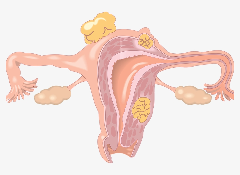 Have You Had Your Vital Cervical Smear Test - Women Body Parts In Hindi, transparent png download