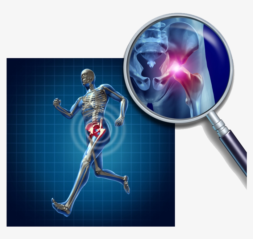 Emu Oil And Sciatica - Joint Bone, transparent png download