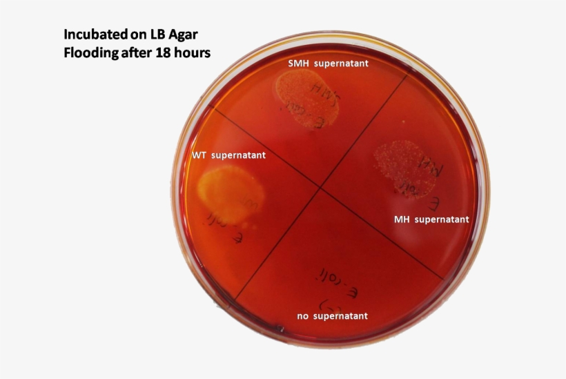 800px-starch3 " " - Pseudomonas Aeruginosa Amylase Test, transparent png download