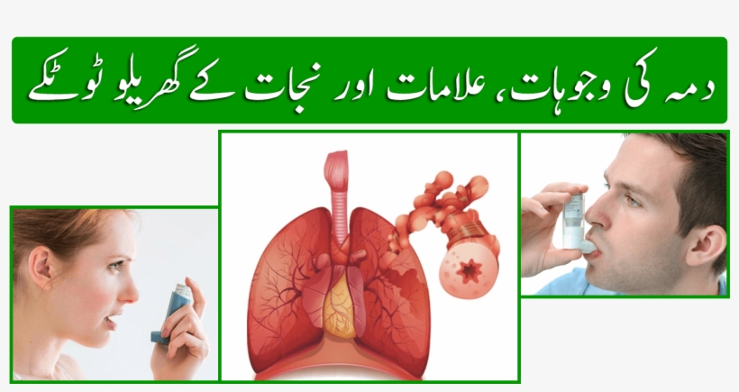 Asthma In Urdu - Poster, transparent png download