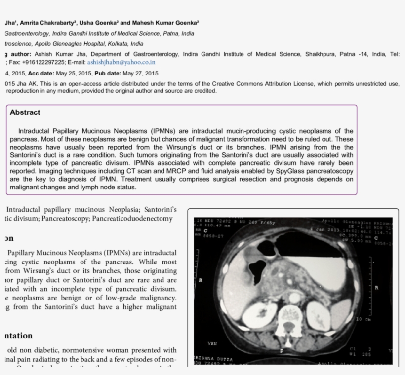 Abdominal Ct-scan Showing A Bulky Head And Uncinate - Skull, transparent png download