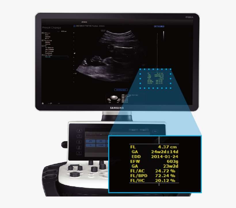 Hycosy In Ceus Hycosy In Ceus - Biometry Assist, transparent png download