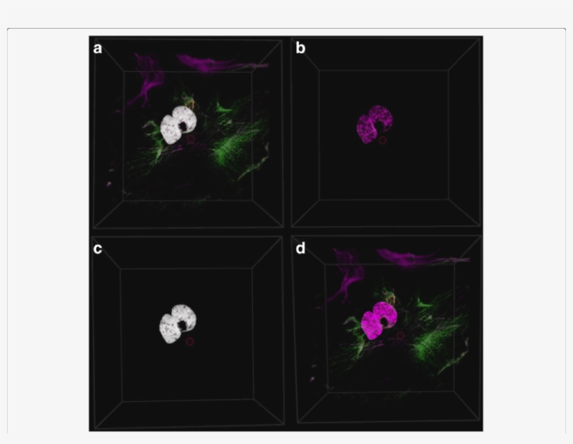 The Colocalization Can Be Rendered In Four Different - Rose, transparent png download