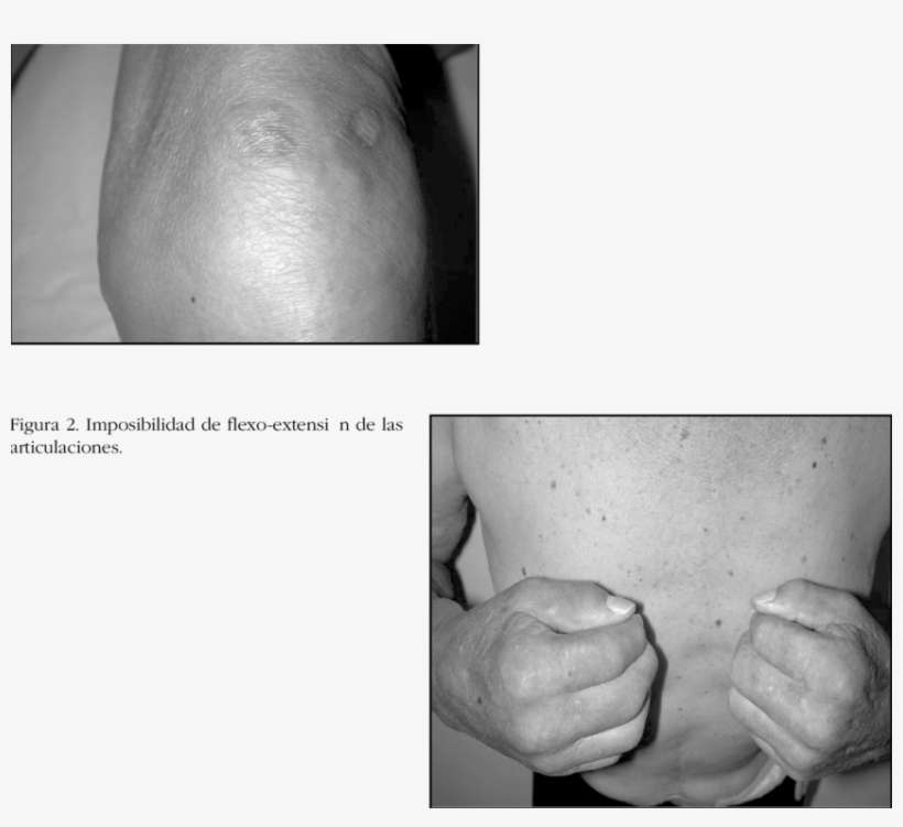 Placa De Borde Irregular Y Proyecciones Ameboideas - Monochrome, transparent png download