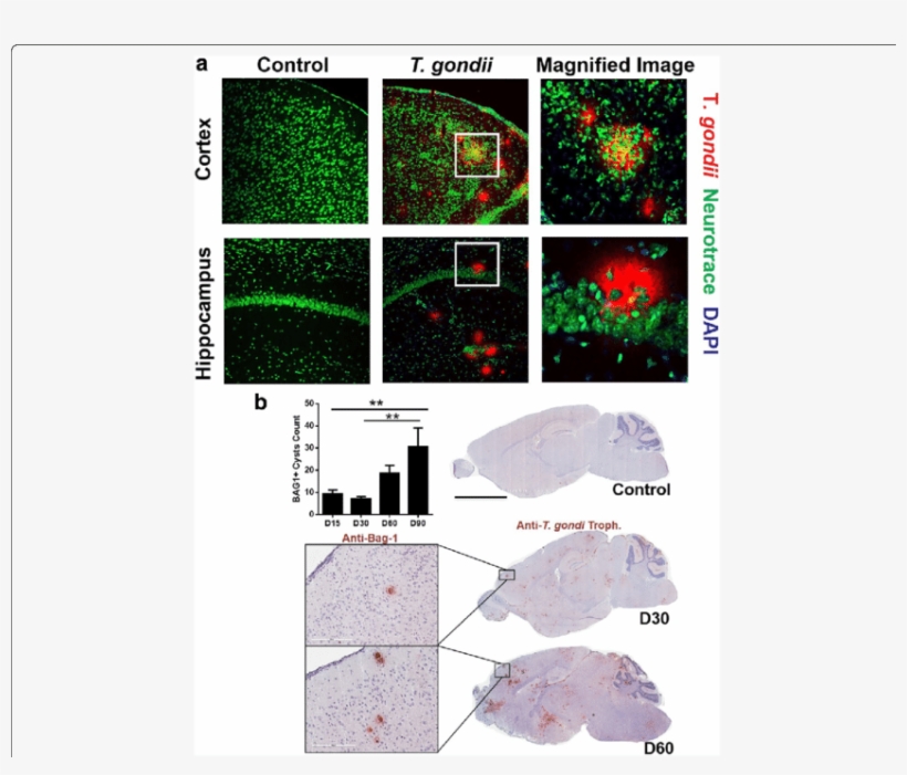 Gondii Associated With Neurons In The Brain - Circle, transparent png download