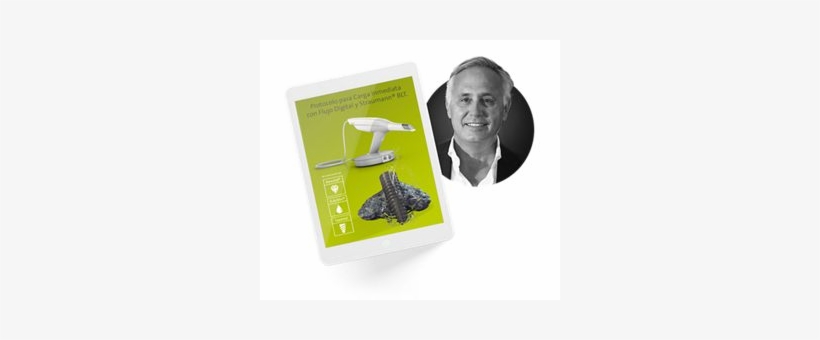 Get 50% Discount On Up To 10 Blt Implants Of Your Choice - American Alligator, transparent png download