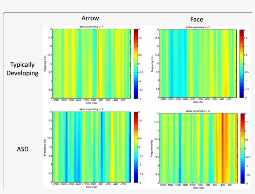 Anticipatory Alpha Asymmetry In Temporal Electrode - Style, transparent png download