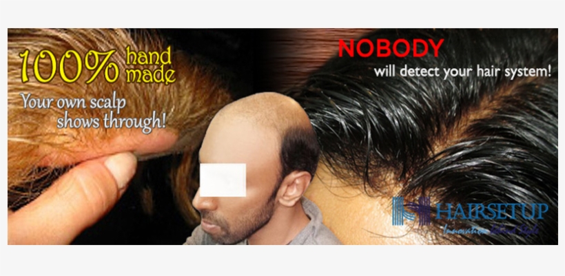 Your Hair Replacement System Is Tailored To Fit - Lace Wig, transparent png download