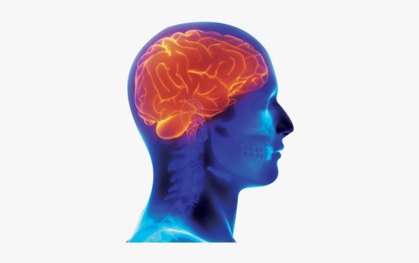 720 X 450 7 - Radiology, transparent png download