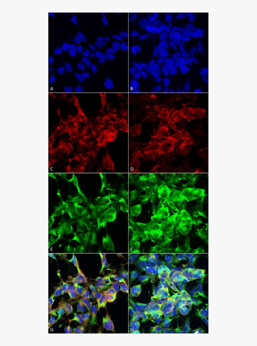 Smc 516 Methylglyoxal Antibody 9e7 Icc If Human Embryonic - Kidney Immunofluorescence Mouse, transparent png download