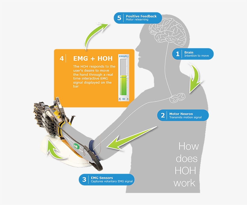 Hand Of Hope Via Rehab-robotics - Robot And Sensors Rehabilitation, transparent png download