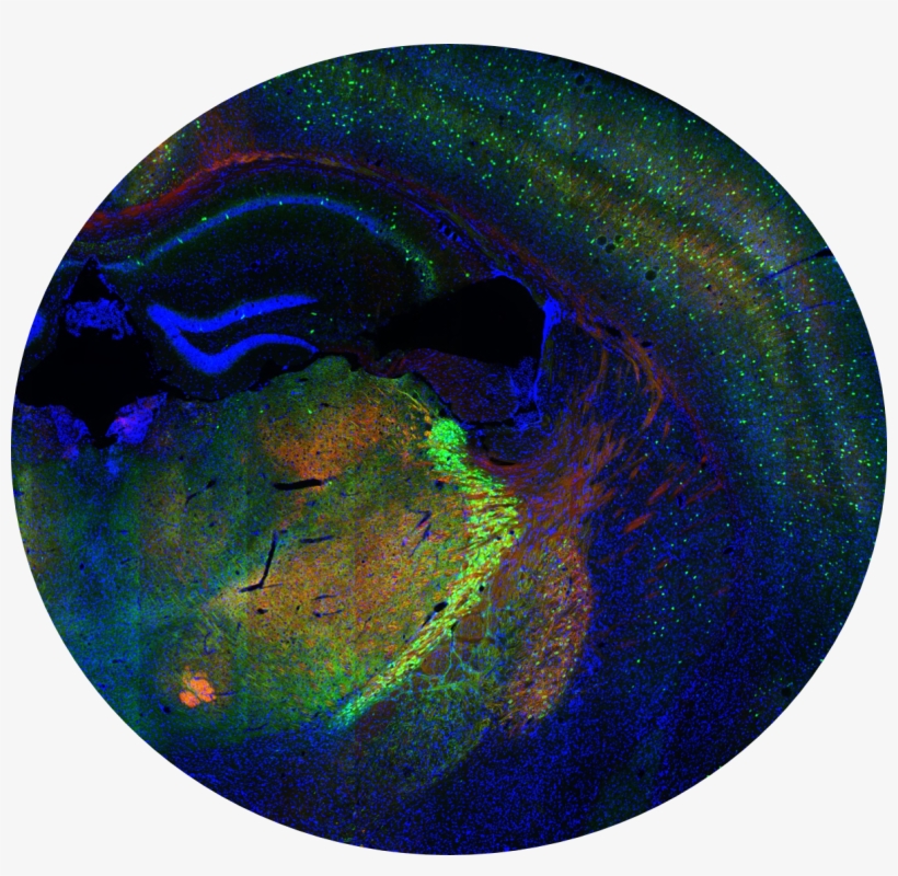One Of Four Images Exemplifying Allen Institute Data - Allen Institute Mouse Brain, transparent png download