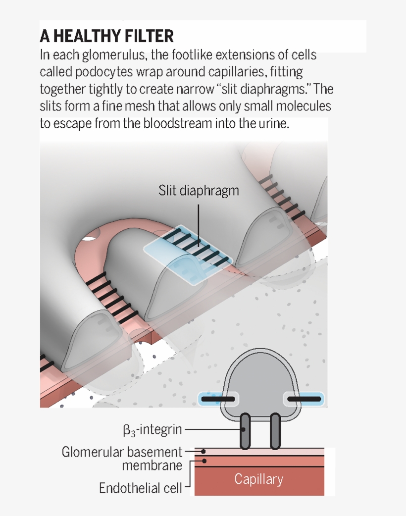 Supar And Kidney Disease - Aerospace Engineering, transparent png download