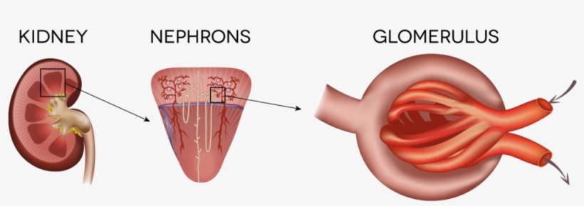 Iga Is An Antibody A Protein Made By The Immune System - Kidney, transparent png download
