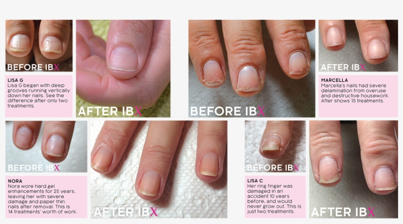 Nail Polish Thicken Nails - Nail Strengthening Treatments, transparent png download