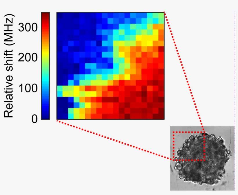 Seeing Inside Tumors To Monitor How Effective An Anticancer - Graphic Design, transparent png download