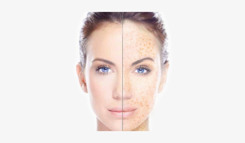 Face Hd Png Transparent Face Hd - Freckle Removal, transparent png download
