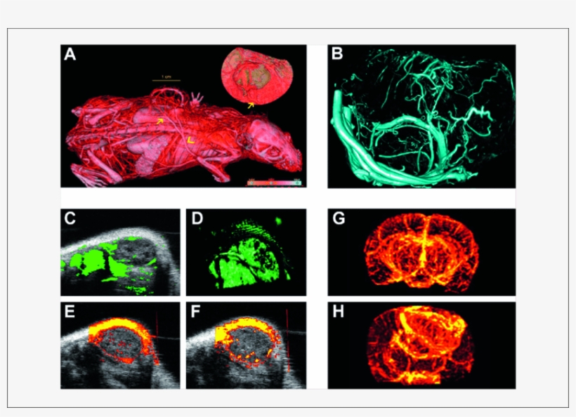 Micro-morphological Imaging Of Tumour Angiogenesis - Graphic Design, transparent png download