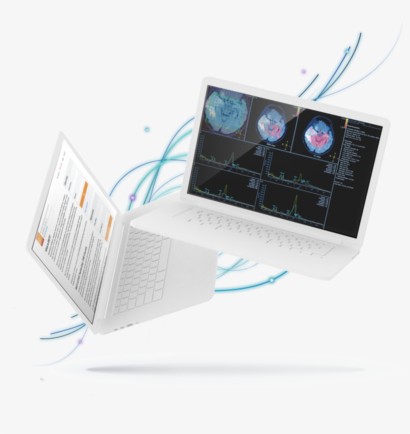 Laptopstreaks800v2 - Output Device, transparent png download