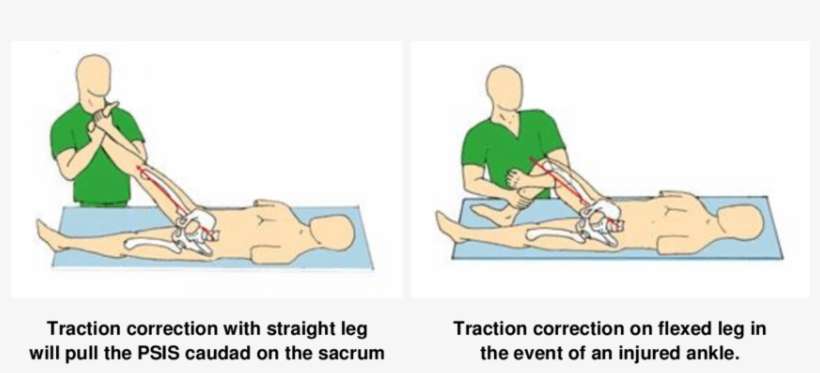 Traction Must Be Strong Enough To Lift The Buttock - Cartoon, transparent png download