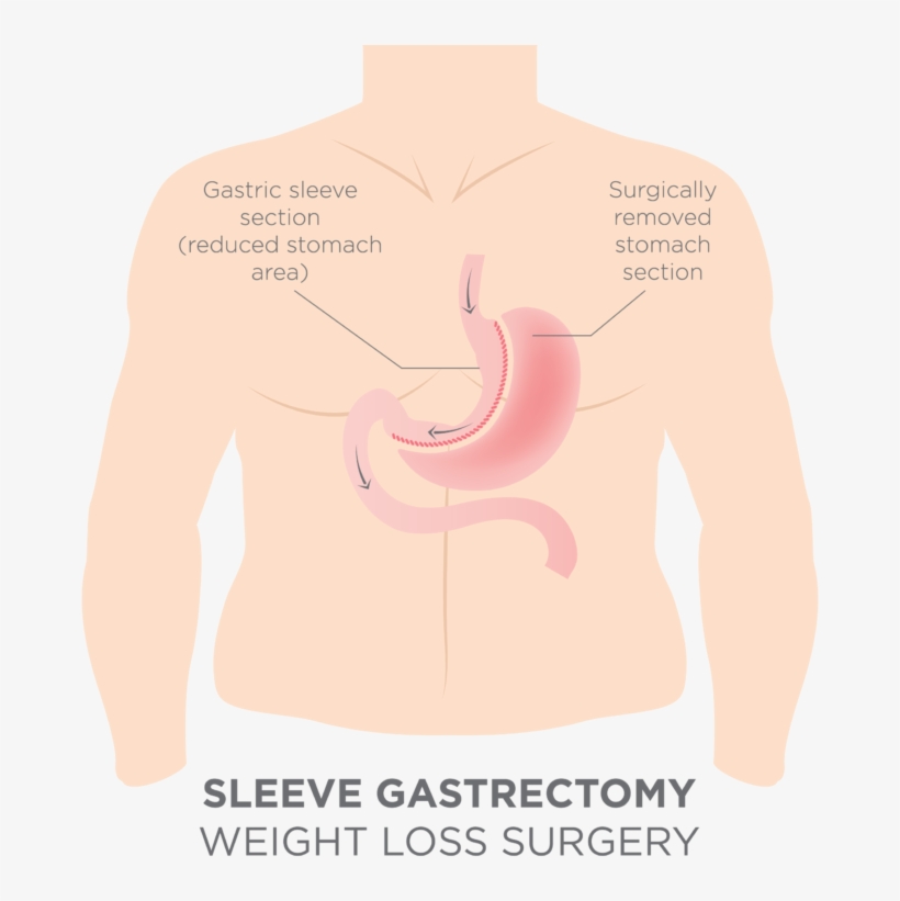 The Sphincter Or Pyloric Valve Remains Intact With - Obama Lied The Economy Died, transparent png download