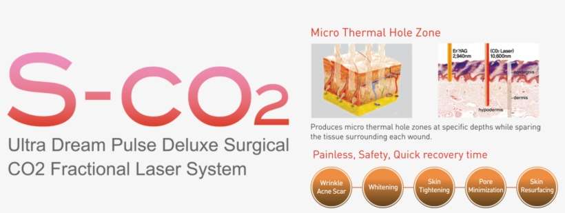 Laser > Vagina Laser > Sco2 Fractional Vaginal - Graphic Design, transparent png download